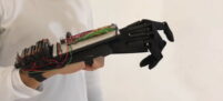 3D печать протеза руки, печать протезов на 3D принтере